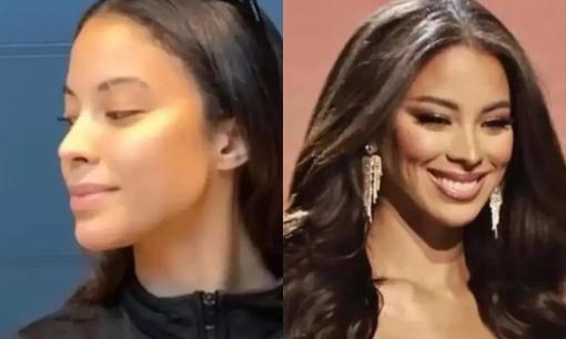 Hậu tiết lộ Miss Universe 2022 có gian lận, Á hậu 2 Andreína Martinez dính nghi vấn phẫu thuật thẩm mỹ 