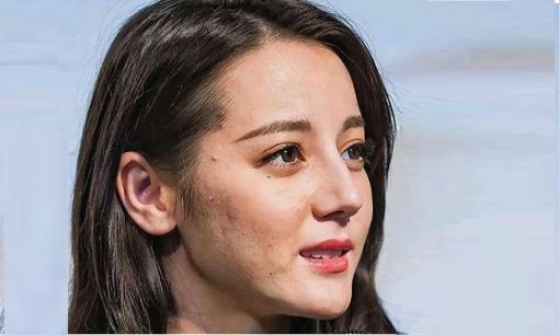 Da giả, răng giả, chiều cao giả, liệu những mỹ nhân làng giải trí Hoa ngữ này còn gì là thật? 