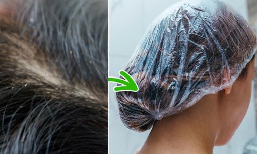 10 lời khuyên được các chuyên gia chứng thực có thể hữu ích để diệt trừ chấy rận