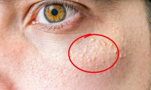 11 dấu hiệu và thói quen hàng ngày khiến bạn già đi nhanh hơn mà bạn không hề nhận ra