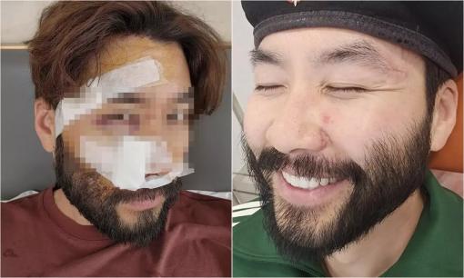 Sức khỏe của nam MC Hàn Quốc gặp tai nạn ở Việt Nam hiện ra sao?