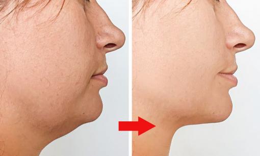 6 lý do chính đáng để tắm hai ngày một lần