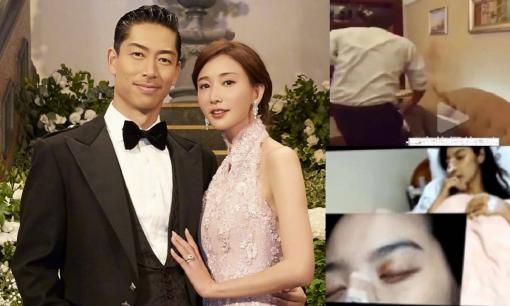 Lộ ảnh Lâm Chí Linh bị bạo hành gia đình, chồng Nhật nhiều lần lừa dối nhưng không dám ly hôn?