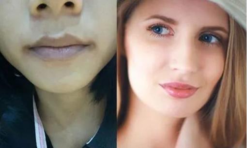 Người có 'đời đoản thọ' sẽ có 3 'điểm đen' trên cơ thể, nếu bạn không có thì bạn rất đáng được chúc mừng