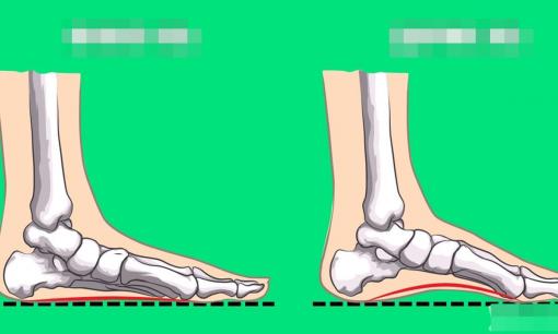 7 bài tập được bác sĩ chuyên khoa bàn chân khuyên dùng giúp giảm đau bàn chân và cải thiện khả năng chịu lực của bàn chân 
