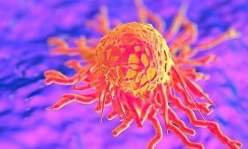 Nếu 'bộ phận' này của cơ thể bị đau, đó có thể là 'tế bào ung thư' sắp thức giấc, đừng bỏ qua!