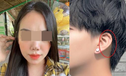 4 lần nâng mũi vẫn chưa ưng, cô gái lên kế hoạch thực hiện lần 5 bằng sụn tai của bạn trai 