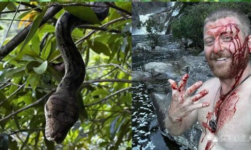 Người đàn ông ở Australia 2 lần tiếp cận con trăn để chụp ảnh và bị cắn 'không thể chịu nổi'