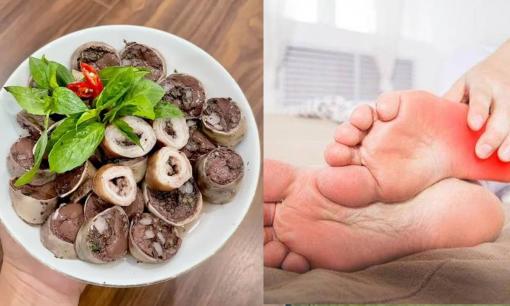 Hai thói quen ăn uống này dễ 'kích động' axit uric tăng cao, khuyên bạn nên tránh sớm nếu không bệnh gút sẽ đến gõ cửa nhà bạn