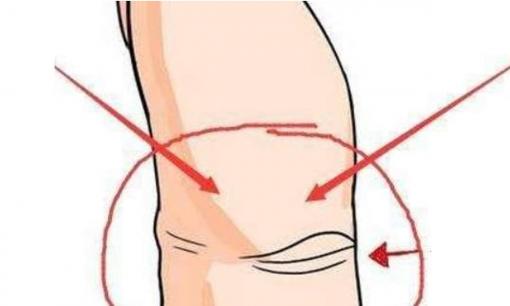 Nếu phụ nữ có 'Mắt thần' ở ngón tay cái bên phải thì nhất định là người giàu có, hãy xem bạn có không nhé!