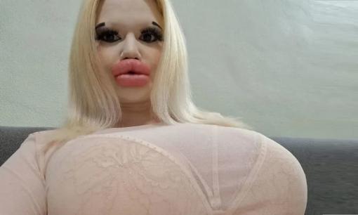 'Búp bê Barbie ngoài đời thực' có đôi môi lớn nhất thế giới công khai muốn hẹn hò và tiếp tục bơm môi 