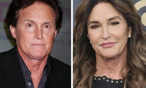 17 người nổi tiếng bây giờ trông giống như những người hoàn toàn mới