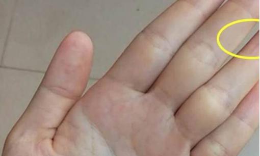 Xem tướng tay: Vị trí giữa năm ngón tay càng rộng thì tình cảm càng dễ xoay chuyển!