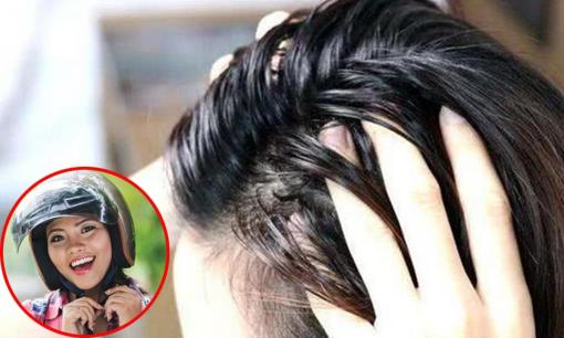 Tóc bết do thường xuyên đội mũ bảo hiểm trong mùa hè, chỉ bạn 3 biện pháp khắc phục cực công hiệu
