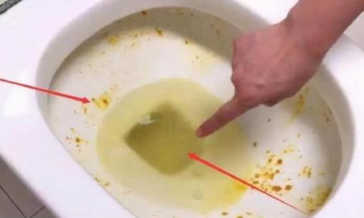 Rắc một ít vào bồn cầu, các vết ố vàng có thể được giải quyết dễ dàng! Nhiều người không biết, siêu dễ làm