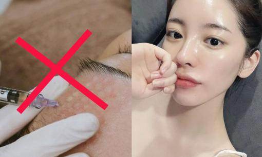 Không phải tiêm Botox hay Meso mà Notox mới đang là xu thế hot, vậy thực chất của phương pháp làm đẹp này là gì?