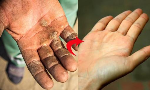 Chai tay, chai chân, dù cứng và thô ráp đến đâu cũng mềm mượt nhờ 6 mẹo, da sẽ mịn màng như 'da em bé' 