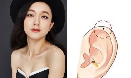 Người có nốt ruồi ở những vị trí này trên mặt thì đường tình duyên tốt đẹp, hôn nhân hạnh phúc, bạn có nốt ruồi nào không?