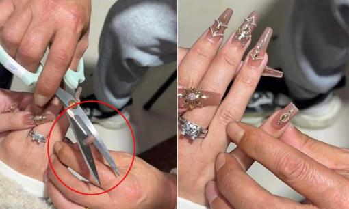 Lấy phải chồng gia trưởng, cô gái không được mặc quần đùi, làm nail liền bị cắt luôn móng tay