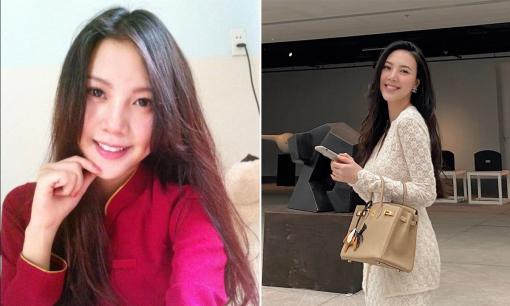 Hot girl Vũ Ngọc Châm cảnh báo tác hại khi làm răng sứ, hối hận thì đã muộn