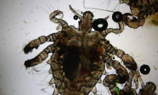 Chấy rận đến từ đâu? Nó có thể lây lan qua hai kênh này và bạn sẽ bị bắt nếu không cẩn thận