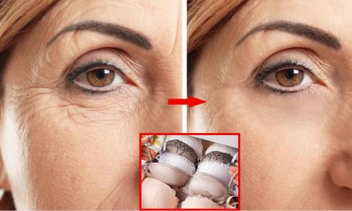 6 lời khuyên khoa học để loại bỏ nếp nhăn, phụ nữ muốn đẹp mà không biết thì thật hối tiếc