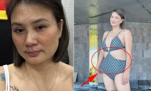 'Hoa khôi bóng chuyền' Kim Huệ đăng ảnh vòng eo ngấn mỡ, gương mặt bị nám 'tảng' gây chú ý