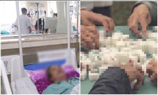 Cụ ông 67 tuổi đột ngột nhồi máu não qua đời trong đêm, bác sĩ nhắc nhở: Thú chơi này lẽ ra phải hạn chế từ lâu