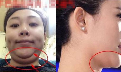 'Ở đây' càng béo thì may mắn của phú quý càng tốt, nhưng nếu giảm cân thì mất may mắn!