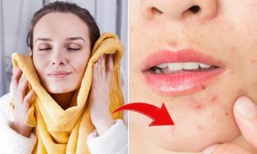Nhiều người vẫn dùng khăn tắm để lau mặt, điều này ảnh hưởng thế nào đến làn da?