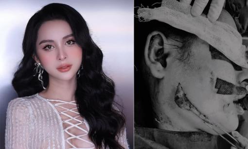 Được Hương Giang khen 'xinh đẹp tự nhiên', mỹ nhân chuyển giới Tường Vi vẫn quyết 'dao kéo'