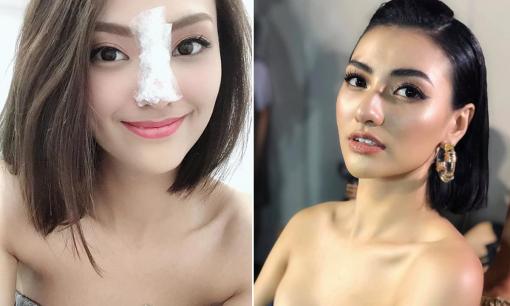 Từng trải qua 2 lần sửa lại dáng mũi, Hồng Quế vẫn thẳng thừng tuyên bố: 'Mặt em không thẩm mỹ'