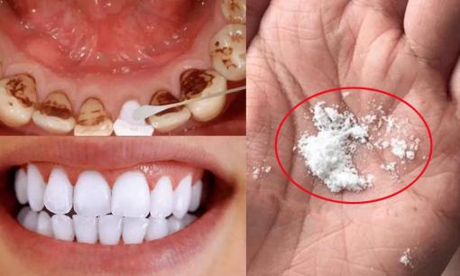 Đừng dùng nước muối để rửa răng vàng và có mùi! Cho thứ này vào nước súc miệng sẽ giúp bạn có hàm răng trắng hơn và hơi thở thơm tho hơn! 