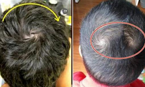 Xoáy tóc trên đầu có thể tiết lộ vận mệnh tương lai, con bạn thuộc nhóm nào, thông minh thần đồng hay giàu có?