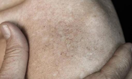 Có ung thư trong cơ thể, tiên tri hậu môn? Bác sĩ: Nếu thường xuyên có 5 loại khó chịu trong người, cảnh giác ung thư đang đến gần