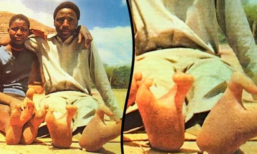 Bộ lạc châu Phi có bàn chân 'đà điểu': Tại sao mỗi bàn chân chỉ có hai ngón?