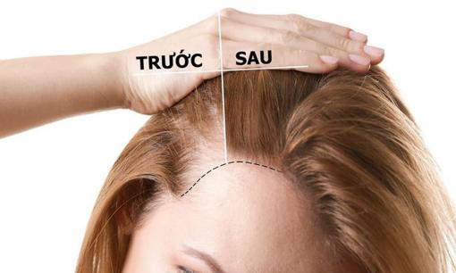 5 cách giúp tóc mọc dài, nhanh, chắc khỏe và đen tự nhiên, phụ nữ nào cũng cần phải biết 