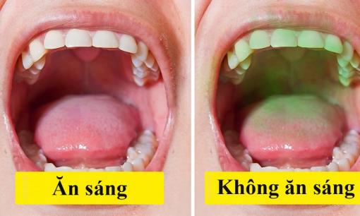 Để hơi thở thơm mát, 5 điều bạn nên làm mỗi ngày 