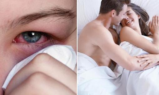 Đang đau mắt đỏ có cần kiêng chuyện 'giường chiếu' không?