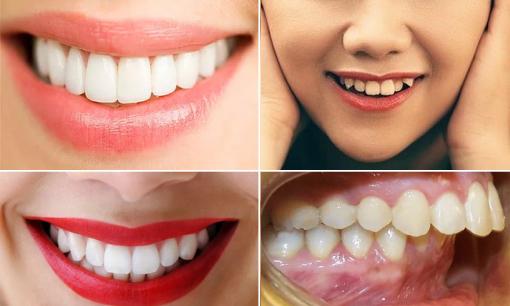 Nhìn tướng răng, đoán ngay vận mệnh tương lai sẽ giàu sang hay nghèo khổ