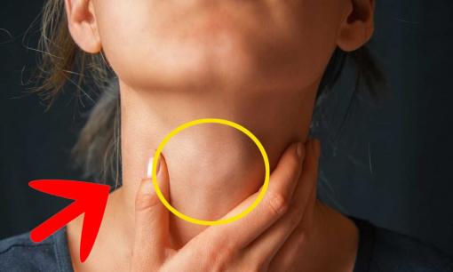 Nếu có ung thư trong cơ thể, cổ có phải là tiên tri? 3 loại bất thường trên cổ có thể là cảnh báo bệnh tật hoặc ung thư