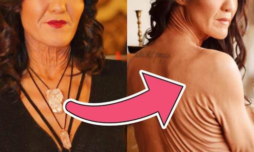 Bây giờ cô ấy đang ở đâu? Người mẫu trẻ từng gây sốt vì mắc chứng da nhăn hiếm gặp, trông như bà lão 80