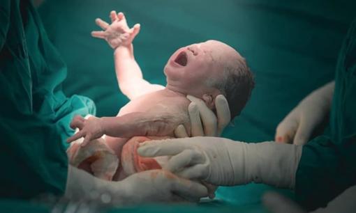 Sự khác biệt giữa sinh thường và sinh mổ không nằm ở trí thông minh của trẻ, sự khác biệt thực sự là ở chỗ này