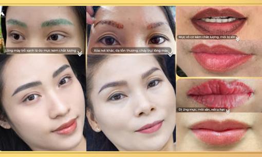 DK Eyebrows & Beauty phát động chiến dịch xóa sửa thảm họa phun xăm