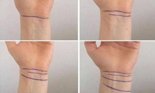Xem ngấn cổ tay trong 3 giây biết ngay tương lai thành công hay thất bại, người có điểm này siêu hiếm 