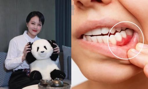 Châu Hải My mắc bệnh giảm tiểu cầu! Bác sĩ tiết lộ 5 triệu chứng cảnh báo bệnh “xuất huyết não”, cẩn thận khi mệt mỏi