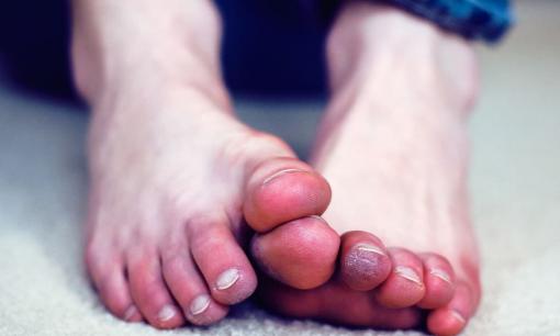 Khi bệnh nặng ập đến, bạn sẽ biết đến qua đôi chân của mình trước tiên, nếu 3 triệu chứng này xuất hiện ở chân thì bạn nên cẩn thận