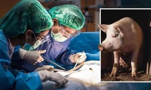 Ca ghép tim lợn đầu tiên trên thế giới đang trong tình thế tiến thoái lưỡng nan giữa sự sống và cái chết, bí mật đằng sau nó là gì?