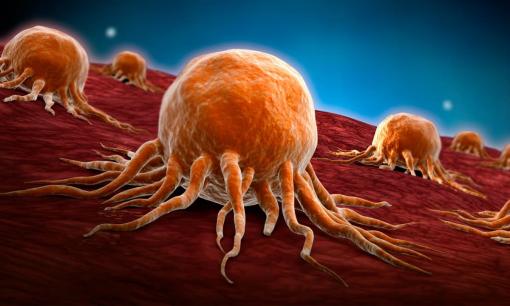 Đột phá lớn trong điều trị ung thư: Các nhà khoa học thí nghiệm thành công phương pháp tiêu diệt 99% tế bào ung thư 