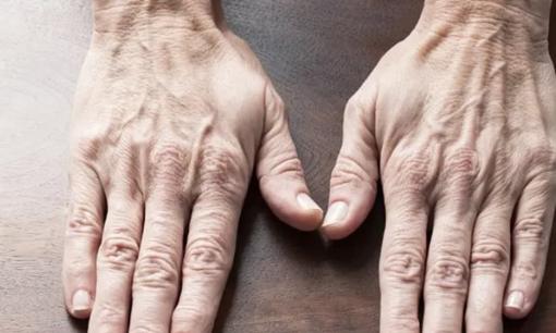 Phần cơ thể này càng mềm thì bạn càng sống lâu! Nếu điều này đúng với bạn thì xin chúc mừng